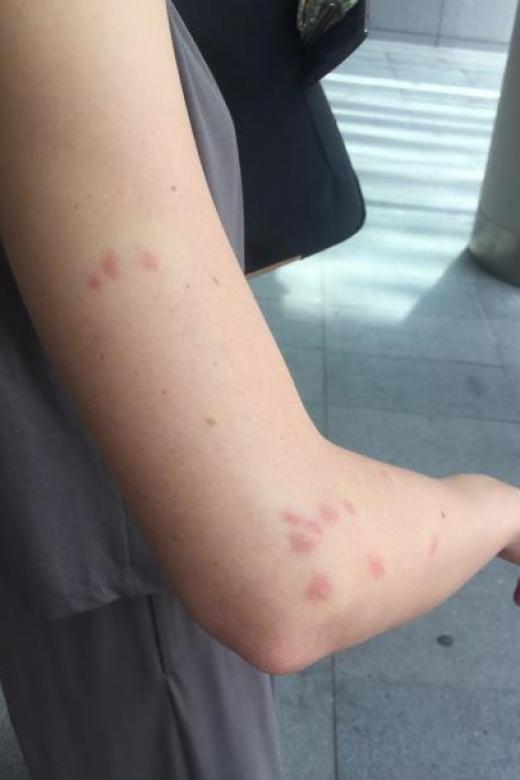 Scoot, Golden Village hit by complaints  of bedbugs from customers