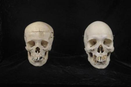 Donated skulls unearth more human remains