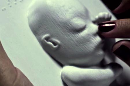 Watch: Blind woman gets to 'see' unborn baby