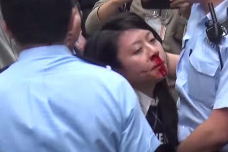 Hong Kong woman convicted of hitting police officer with her breast