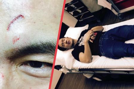 Adrian Pang cuts head during LKY Musical, continues with blood dripping down his face