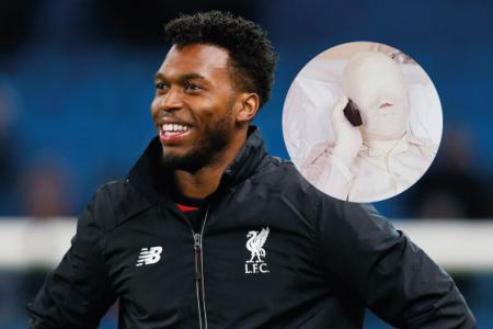Daniel Sturridge's injury nightmare continues, Internet as caring as ever