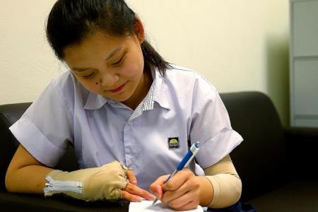 Girl who lost fingers clears N-level exams
