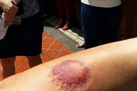 Security guard bitten on arm in scuffle at clan meeting