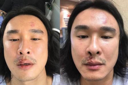 Julian Hee alleged assault