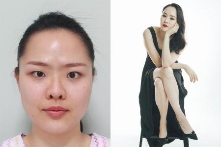 Singapore women gain confidence after cosmetic surgery
