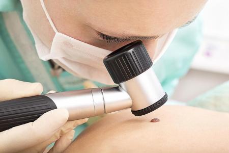 Skin cancer hits younger patients