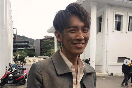 Actor Kai Ko said to be seriously disfigured after drone accident on set