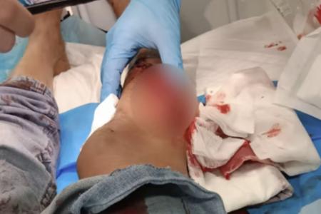 Wild boar attacks woman in Bukit Panjang, bites then drags her onto the road