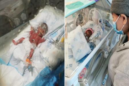 Premature baby requires machine to breathe, parents start fundraiser to pay for bills