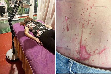 Woman seeks compensation after TCM treatment goes wrong