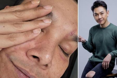 'Put a smile on your face': Ryan Lian shares scar photos