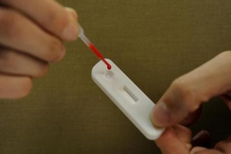 HIV self-test swab kits to go on sale from Aug 1, as new cases fall to new low in 2021