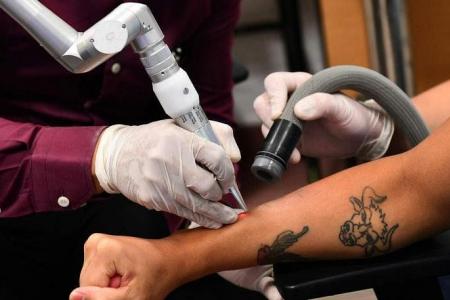 Tattoo removals subsidised for young people finding work or trying to stay in school 