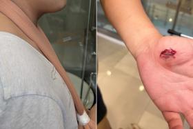 One man dislocated his right shoulder and suffered two bite wounds after an altercation at Kinex mall on Nov 9. 