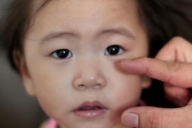 SCARE: Mr Wong (not in picture) demonstrating the length of the 5cm fish bone compared to his daughter&#039;s face.