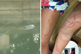 Ms Jade Dyson was badly stung by a box jellyfish (similar to the one above) when she was swimming at East Coast beach.
