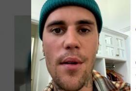 Part of Justin Bieber's face is paralysed