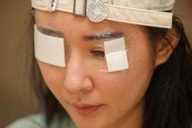 Aden, 32, suffered formaldehyde-induced conjunctivitis and wound infection of the eye after renovating her apartment. 